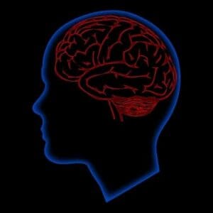 Brain injuries-scan-Seattle-Injury-Law